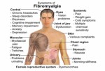 Fibromyalgia Plr Articles