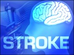 Stroke Prevention Plr Articles