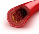 Cholesterol Plr Articles