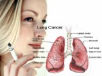 Cancer Plr Articles v2