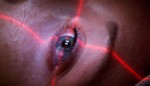 Laser Eye Surgery Plr Articles
