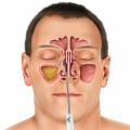 Sinus Infections Plr Articles