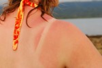 Skin Cancer Plr Articles