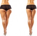 Liposuction Plr Articles v2