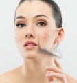 Acne Plr Articles v14