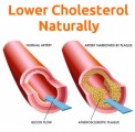 Lower Cholesterol Plr Articles 