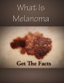 What Is Melanoma Get The Facts Plr Ebook