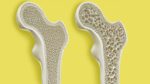 Osteoporosis Plr Articles V2