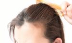 Women Hair Loss Plr Articles