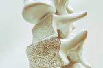 Osteoporosis Plr Articles v3