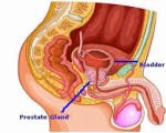 Prostrate Plr Articles